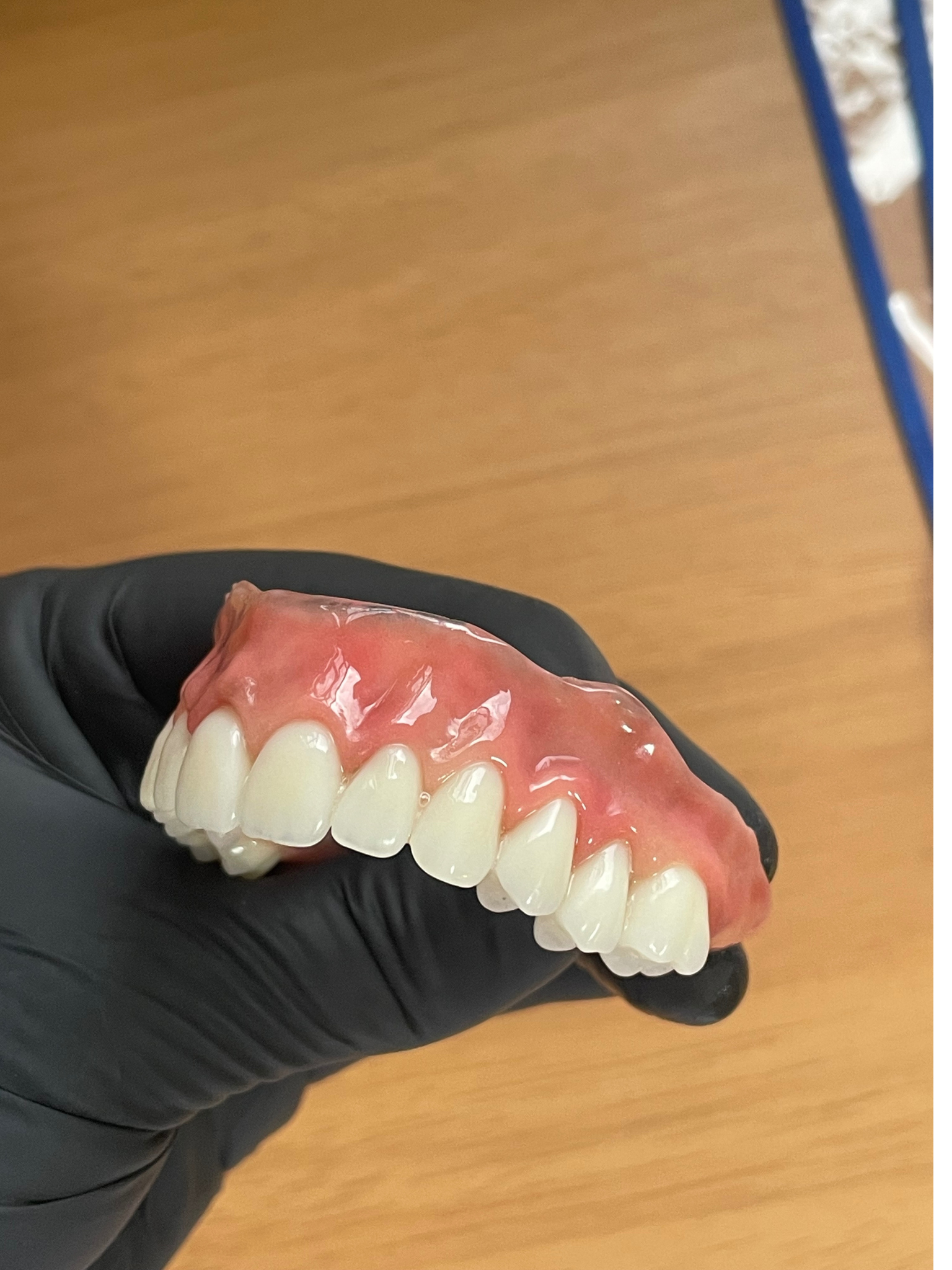 Resultado Prótese Total