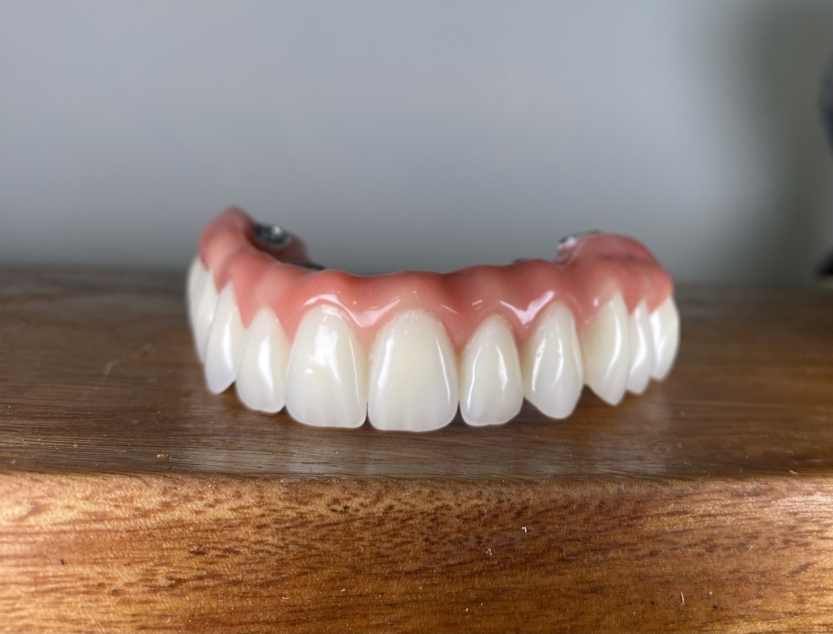 Transformação Prótese Protocolo