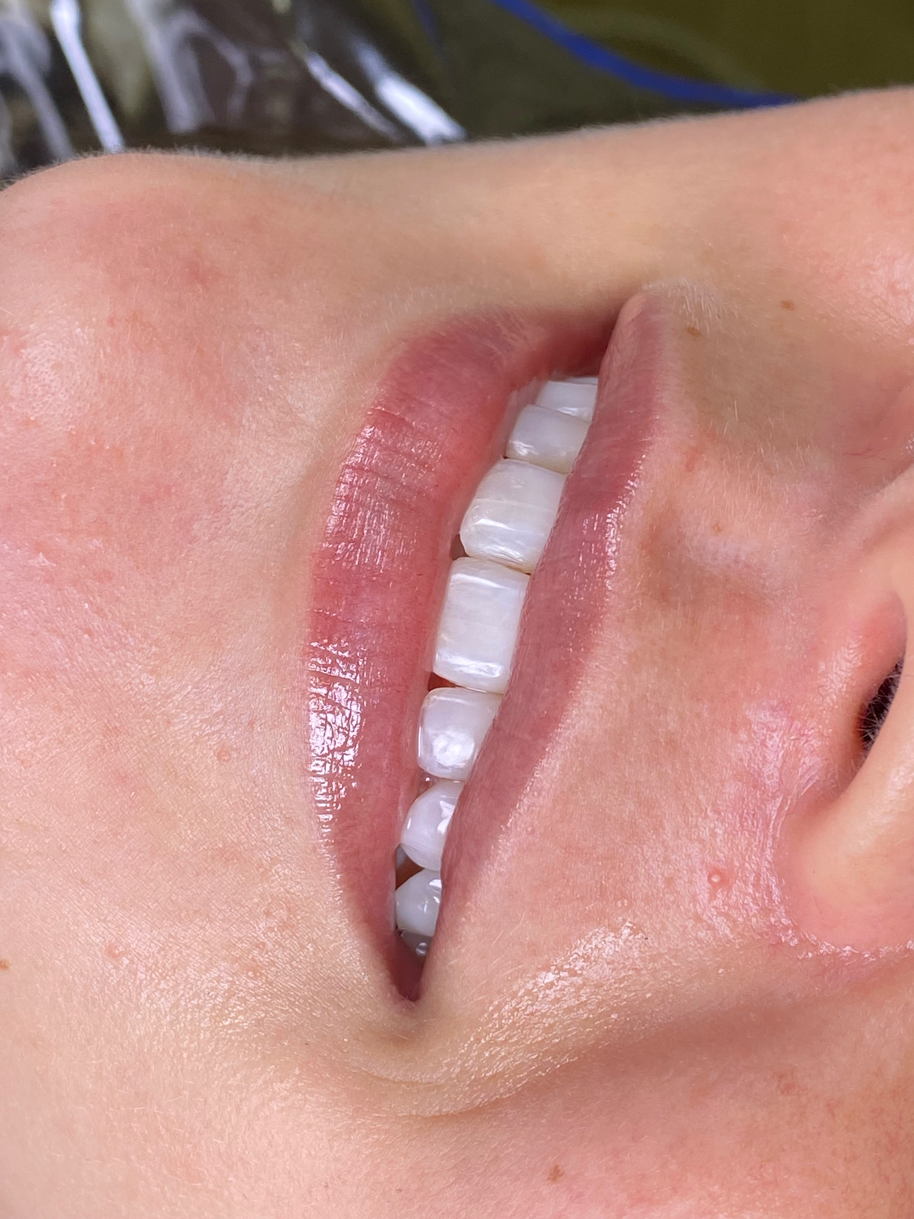 Resultado Dentística